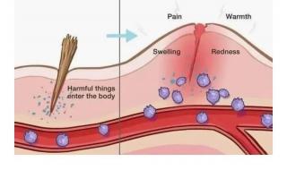 吞刀片怎么缓解疼痛 吞刀片怎么缓解疼痛